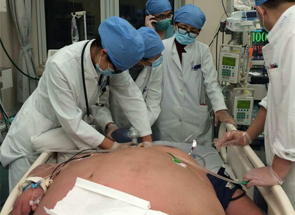 呼吸内科联合多科室成功救治一名重症肺炎合并严重肥胖低通气患者