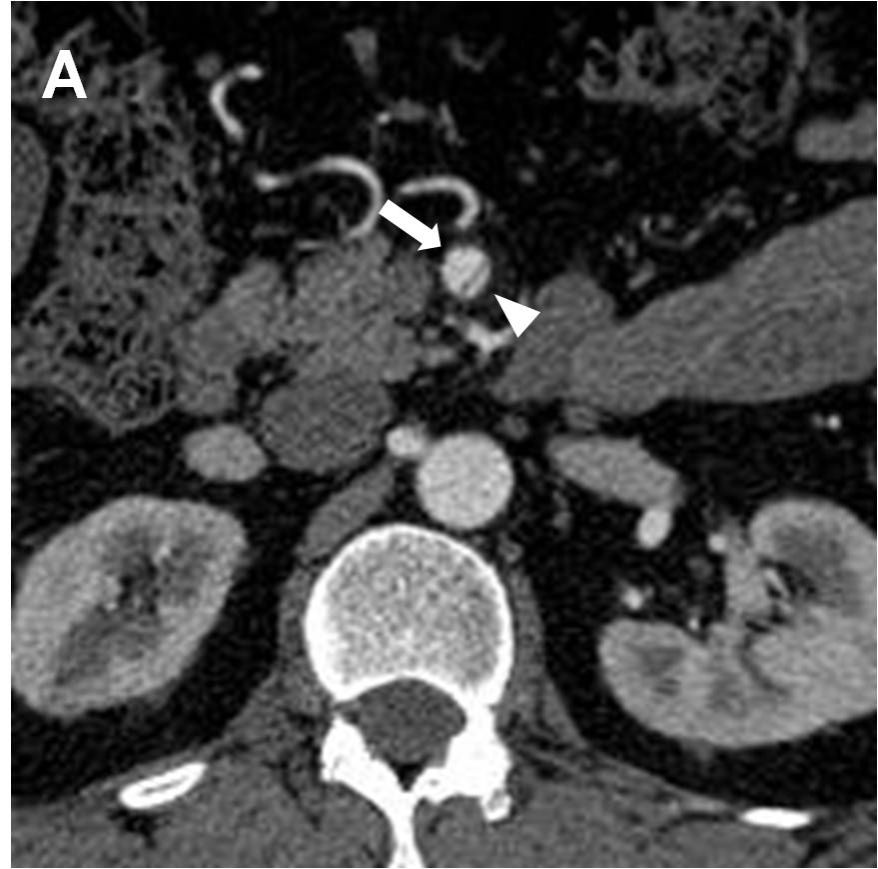 An x-ray of a kidneyDescription automatically generated with low confidence