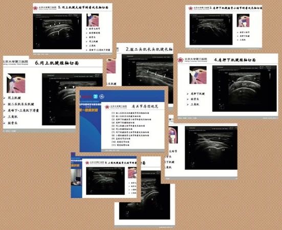 北医三院肌骨超声跨区域医联体开展网络远程学习