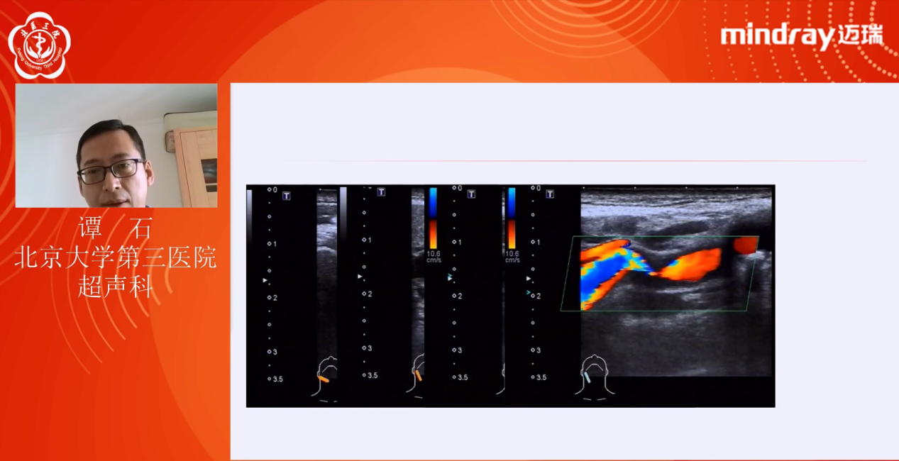 2020年北京大学第三医院《健康体检超声规范化培训班》网上开讲