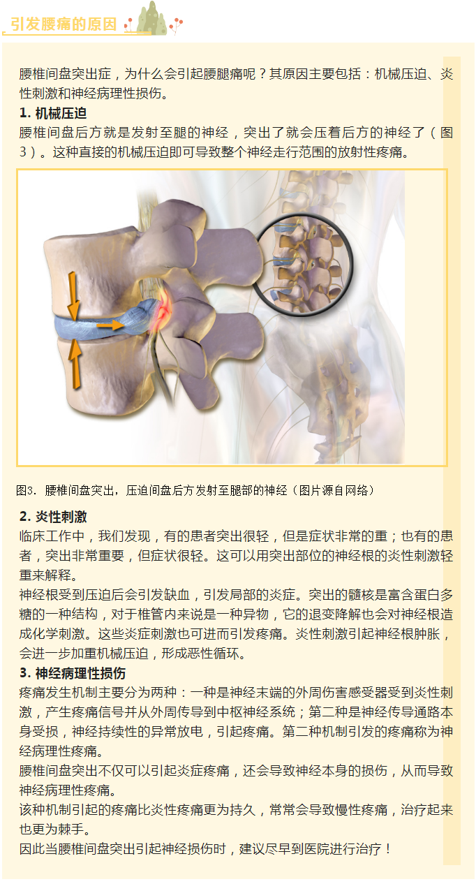 腰痛腿痛，小心腰椎间盘突出！