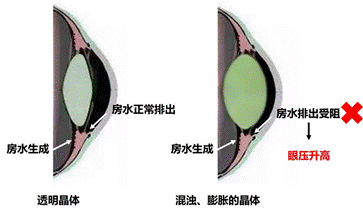 爱眼日特辑：后疫情时代之眼科六宗罪