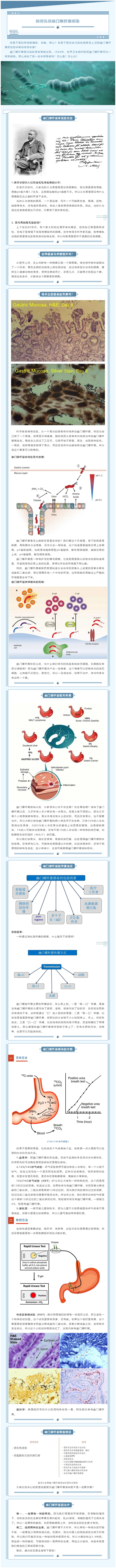 终结幽门螺杆菌疑问，专家帮您健康无“幽”