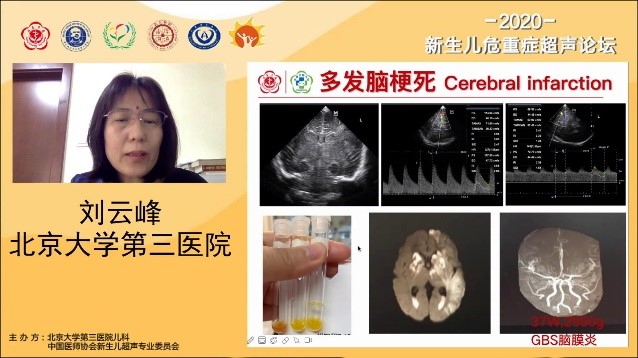 儿科举办2020新生儿危重症超声线上论坛