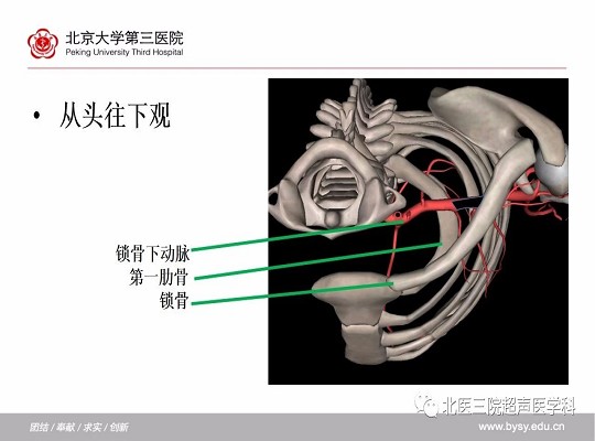 锁骨下动脉≠“锁骨下的”动脉