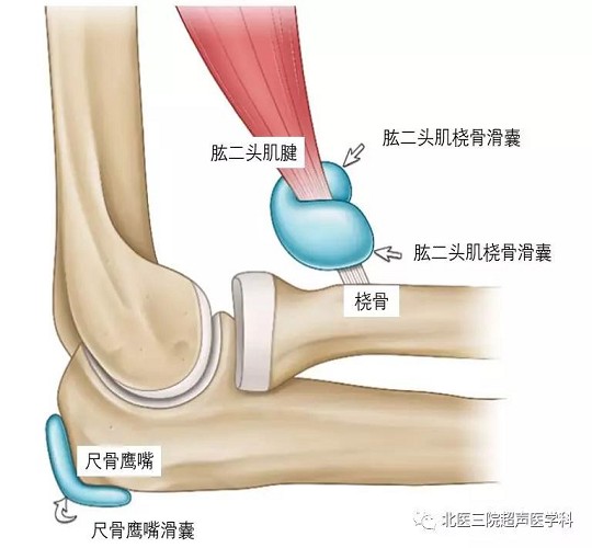 滑囊的超声评估-解剖及常见病变（二）