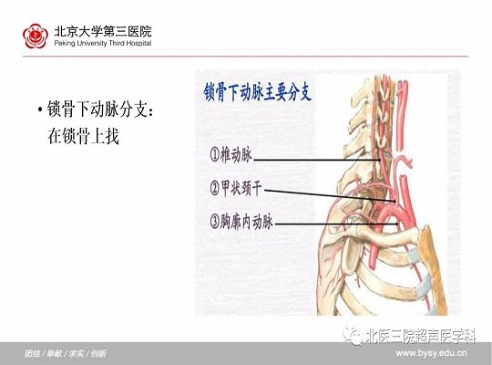 锁骨下动脉≠“锁骨下的”动脉