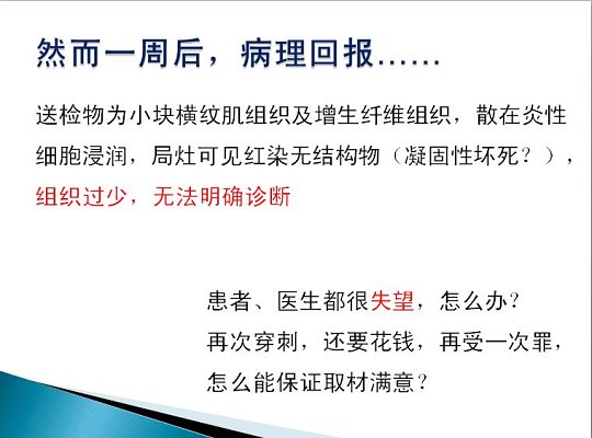 第三届中国超声造影大会病例大赛北医三院超声科获奖病例展示（四）