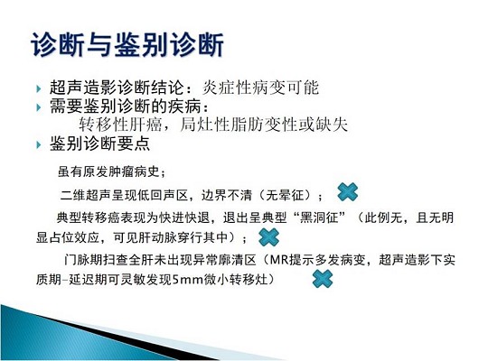 第三届中国超声造影大会病例大赛北医三院超声科获奖病例展示（二）