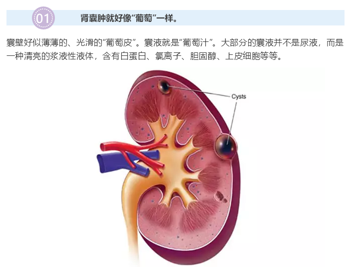 肾脏上长出的“葡萄”