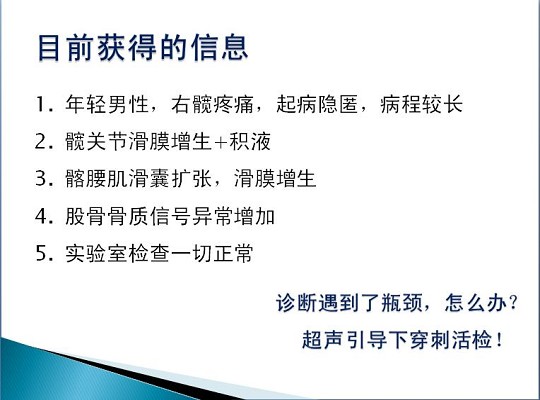 第三届中国超声造影大会病例大赛北医三院超声科获奖病例展示（四）