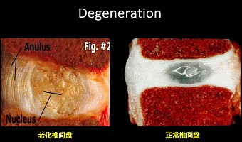 如何拯救“低头族”的颈椎？专家给出终极方案