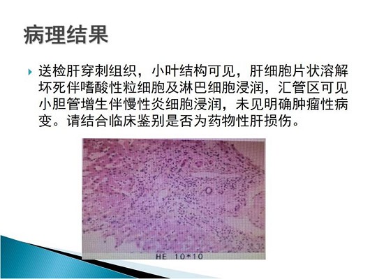 第三届中国超声造影大会病例大赛北医三院超声科获奖病例展示（二）