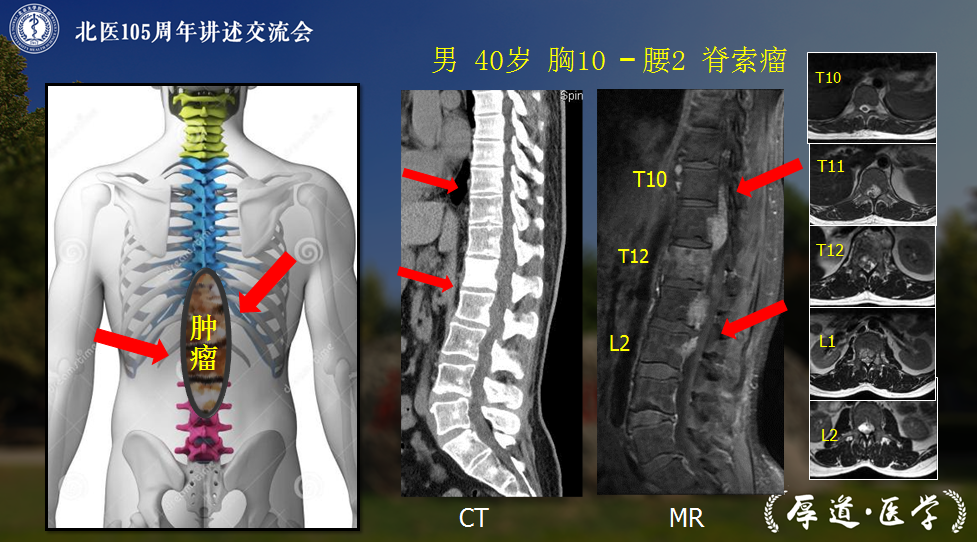 北医105周年·讲述｜北医三院刘忠军：做撑起中国脊梁的北医人