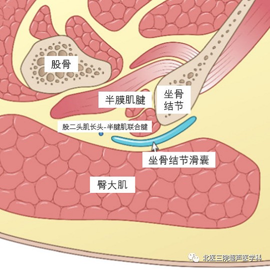 滑囊的超声评估-解剖及常见病变（二）