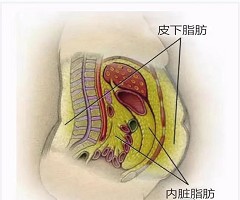 “苗条”的胖子，警惕“隐性肥胖”