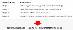 应对膝关节的“炎”重警告，康复医学专家给您支招！