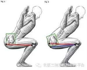 健身族如何预防膝关节疼痛