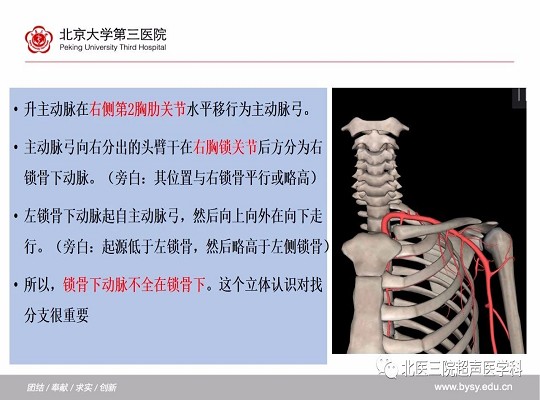 锁骨下动脉≠“锁骨下的”动脉