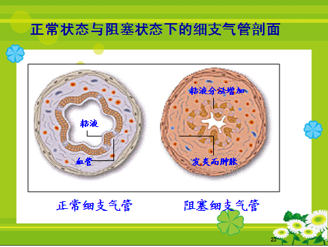 哮喘防治知识