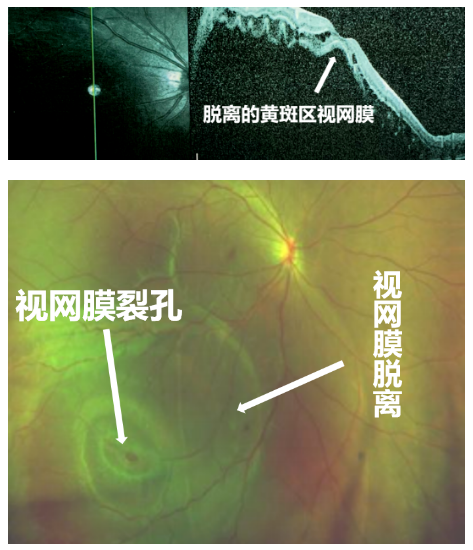 援藏纪实 | 援藏医生紧急手术，雪域少年重见光明