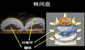 如何拯救“低头族”的颈椎？专家给出终极方案