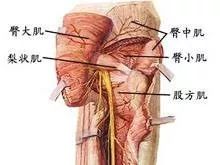 腰腿屁股痛，除了腰椎间盘突出还可能因为它