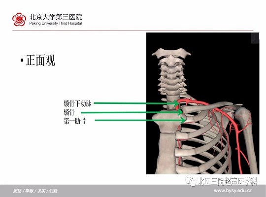 锁骨下动脉≠“锁骨下的”动脉