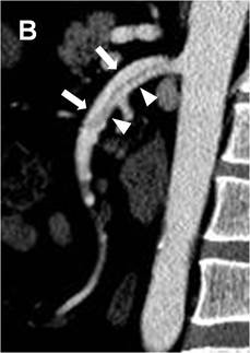 A close-up of an mri scanDescription automatically generated with low confidence