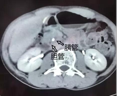 援藏后记 | 微信群牵线千里会诊，藏族小伙来京就医