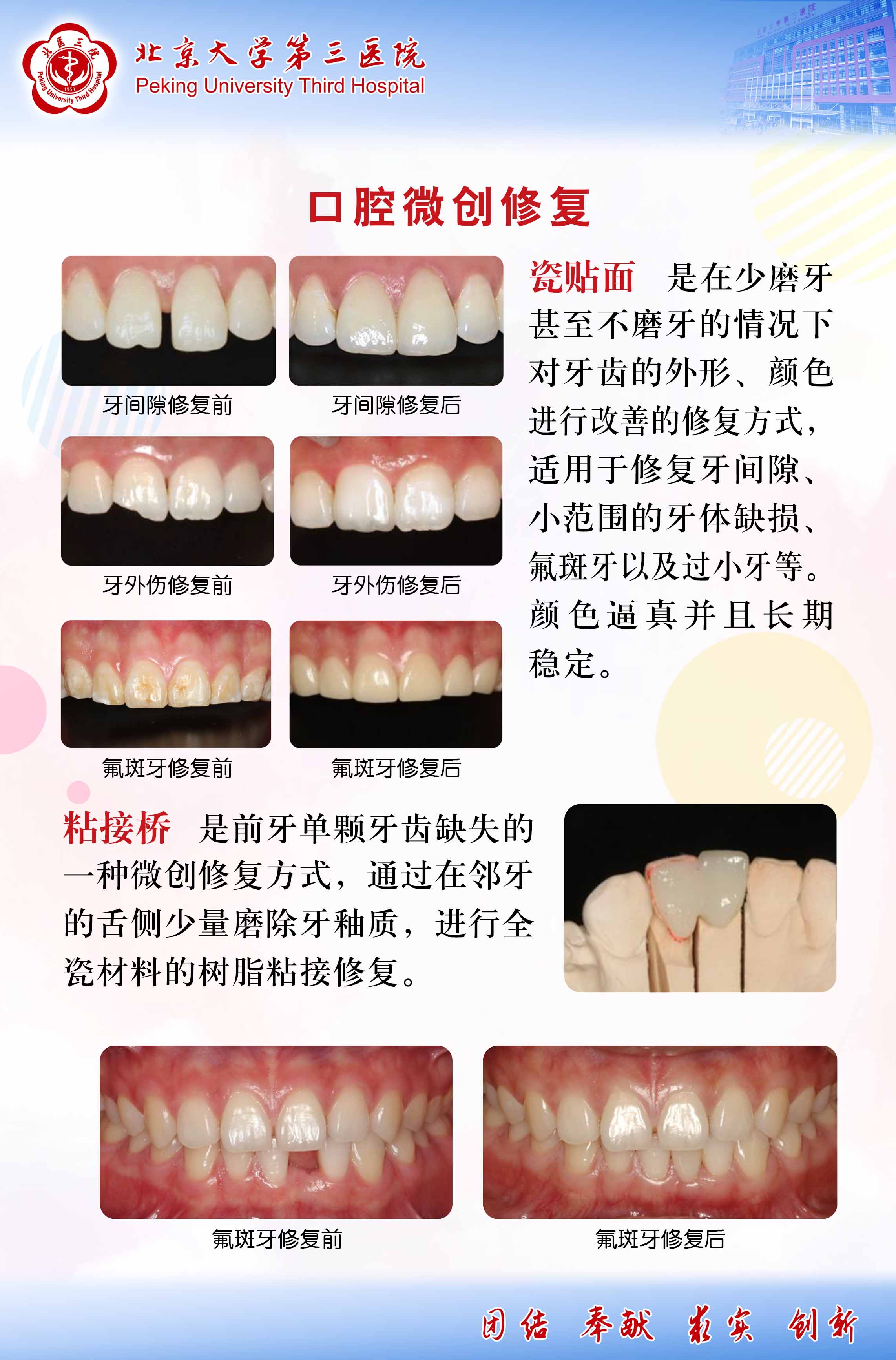 口腔微创修复