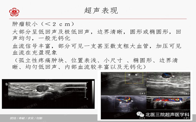 五大痛性浅表肿瘤（一）